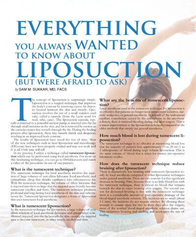 EVERYTHING YOU ALWAYS WANTED TO KNOW ABOUT LIPOSUCTION (BUT WERE AFRAID TO ASK)