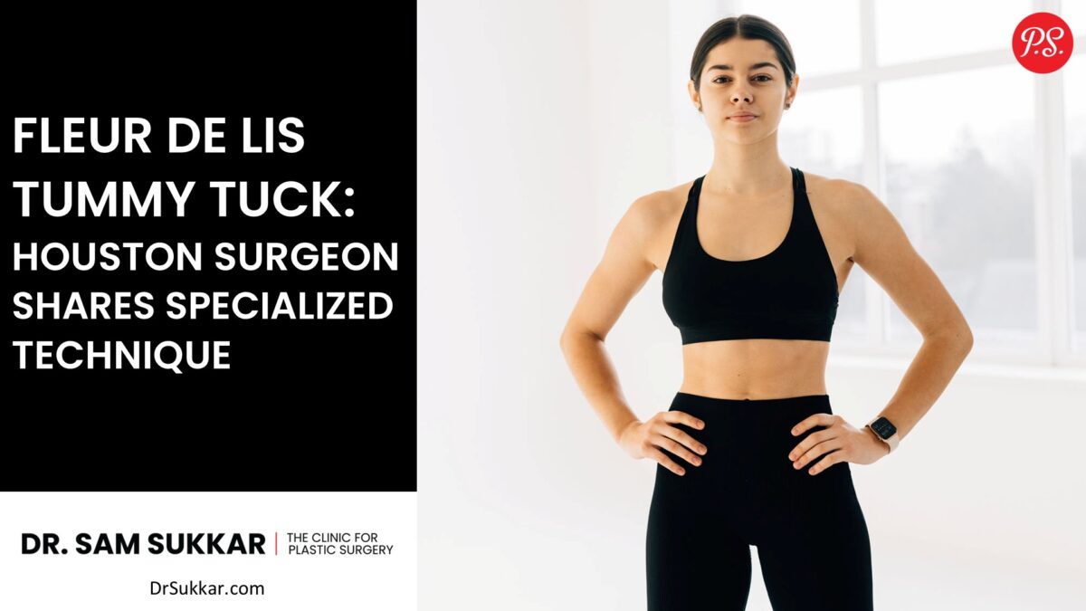 Fleur De Lis Tummy Tuck: Houston Surgeon Shares Specialized Technique by Dr. Sam Sukkar, MD