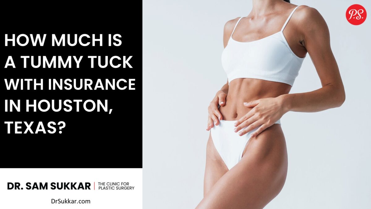 How Much Is a Tummy Tuck With Insurance in Houston, Texas? By Dr. Sam Sukkar, MD