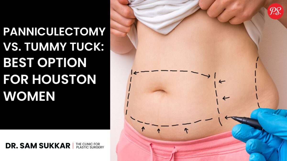 Panniculectomy vs Tummy Tuck: Best Option for Houston Women by Dr. Sam Sukkar, MD
