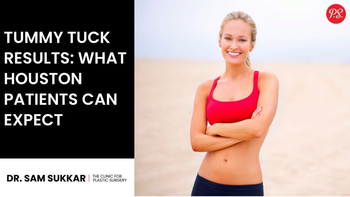 Tummy Tuck Results: What Houston Patients Can Expect by Dr. Sam Sukkar, MD