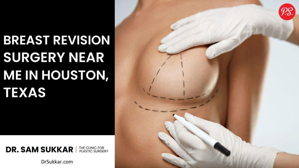 Breast Revision Surgery Near Me in Houston, TX by Dr. Sam Sukkar, MD