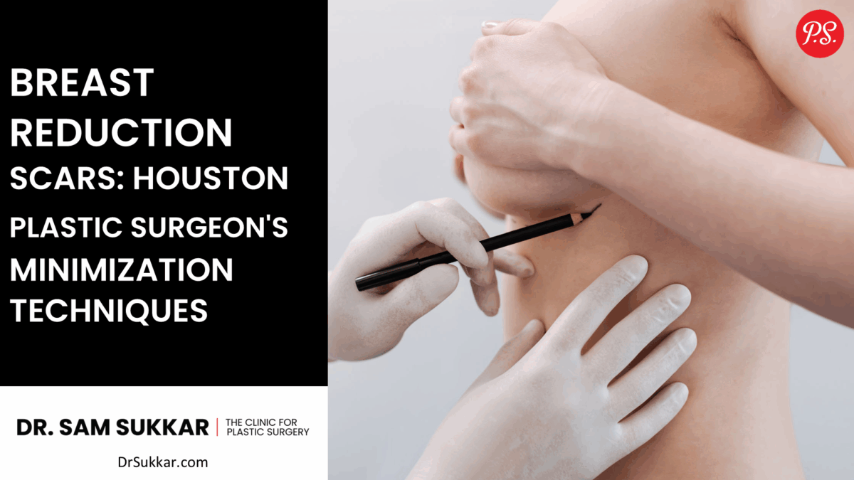 Breast Reduction Scars: Houston Plastic Surgeon's Minimization Techniques by Dr. Sam Sukkar, MD