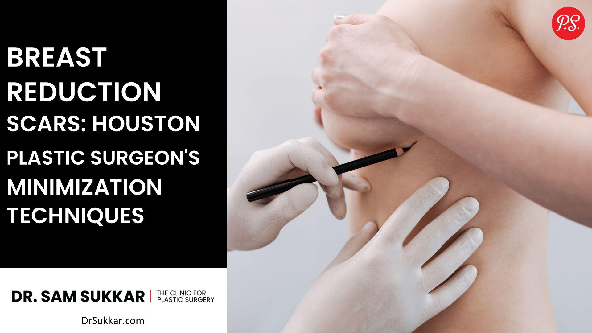 Breast Reduction Scars: Houston Plastic Surgeon&#8217;s Minimization Techniques
