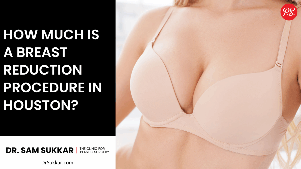 How Much is a Breast Reduction Procedure in Houston? by Dr. Sam Sukkar, MD