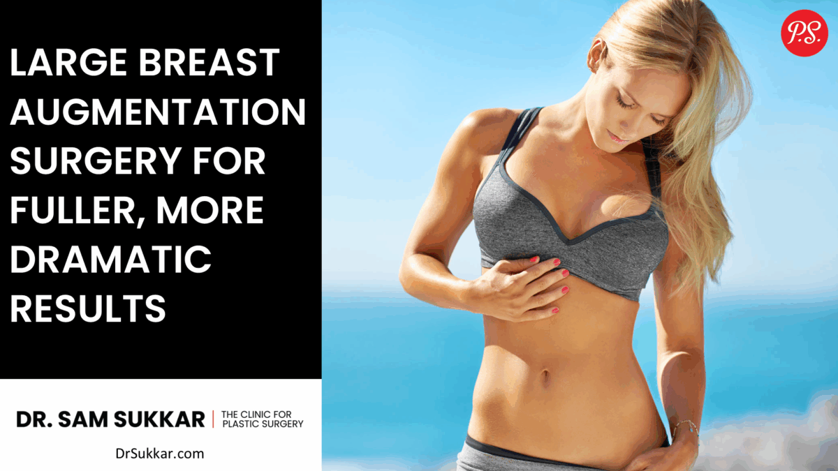 Large Breast Augmentation Surgery for Fuller, More Dramatic Results by Dr. Sam Sukkar, MD