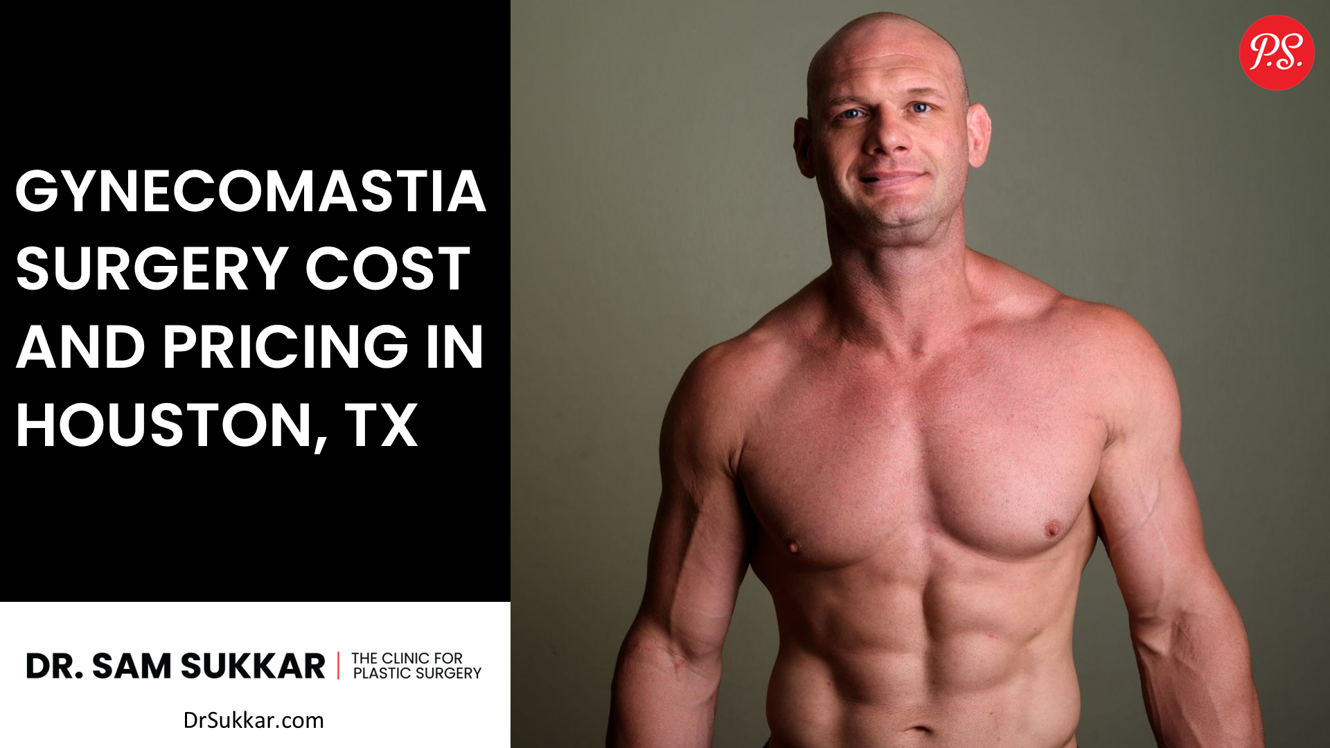 Gynecomastia Surgery Cost and Pricing in Houston, TX