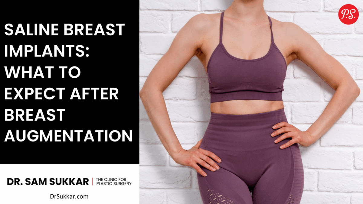 Saline Breast Implants: What to Expect After Breast Augmentation by Dr. Sam Sukkar, MD