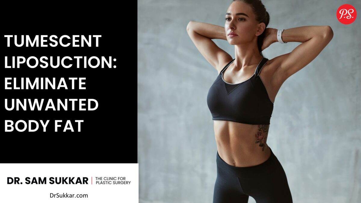 Tumescent Liposuction: Eliminate Unwanted Body Fat in Stubborn Areas by Dr. Sam Sukkar, MD