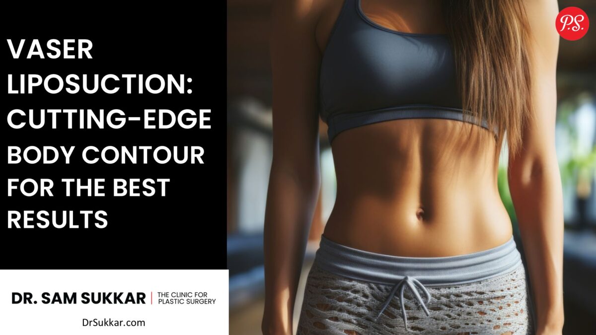 Vaser Liposuction: Cutting-Edge Body Contouring for the Best Results by Dr. Sam Sukkar, MD