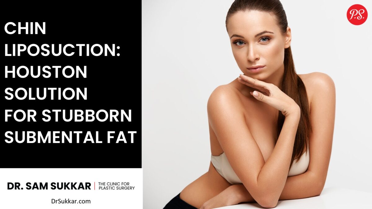 Chin Liposuction: Houston Solution for Stubborn Submental Fat by Dr. Sam Sukkar, MD