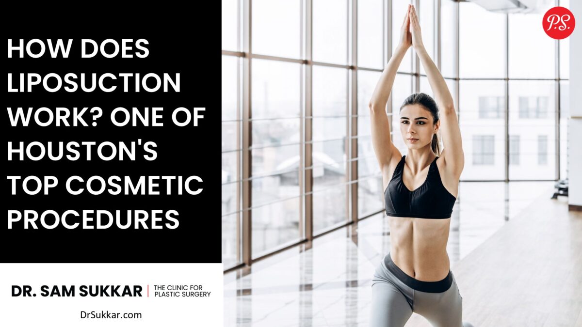 How Does Liposuction Work? One of Houston's Top Cosmetic Procedures by Dr. Sam Sukkar, MD