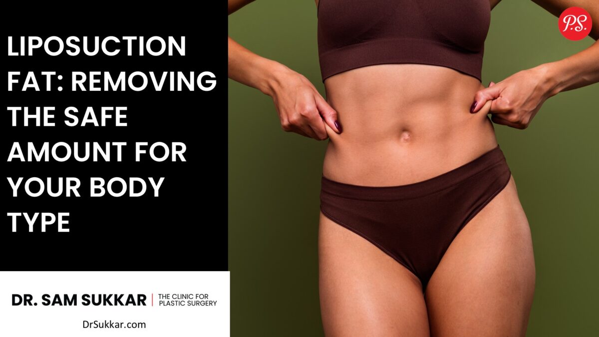 Liposuction Fat: Removing the Safe Amount for Your Body Type by Dr. Sam Sukkar, MD