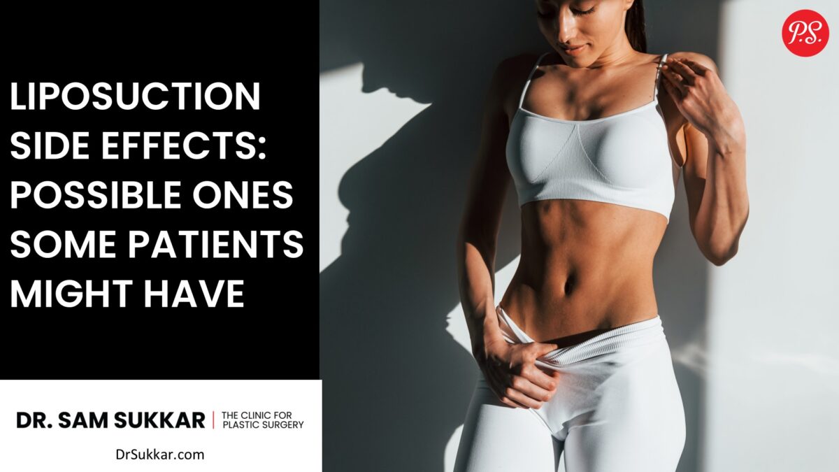 Liposuction Side Effects: Possible Ones Some Patients Might Have by Dr. Sam Sukkar, MD