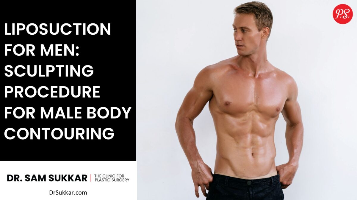 Liposuction for Men: Sculpting Procedure for Male Body Contouring by Dr. Sam Sukkar, MD