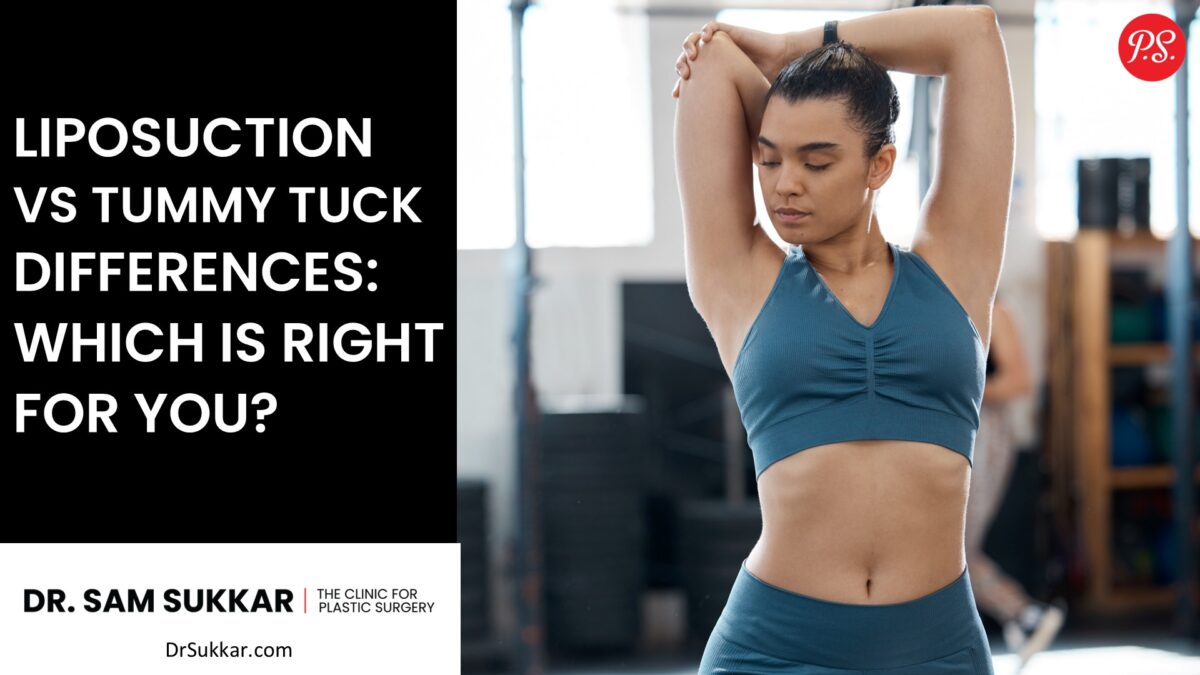 Liposuction vs Tummy Tuck Differences: Which is Right for You? by Dr. Sam Sukkar, MD