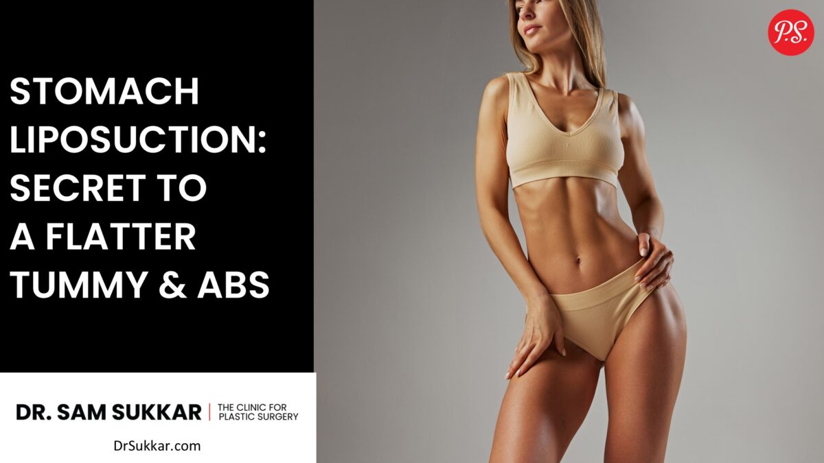 Stomach Liposuction: Secret to a Flatter Tummy and Abs by Dr. Sam Sukkar, MD