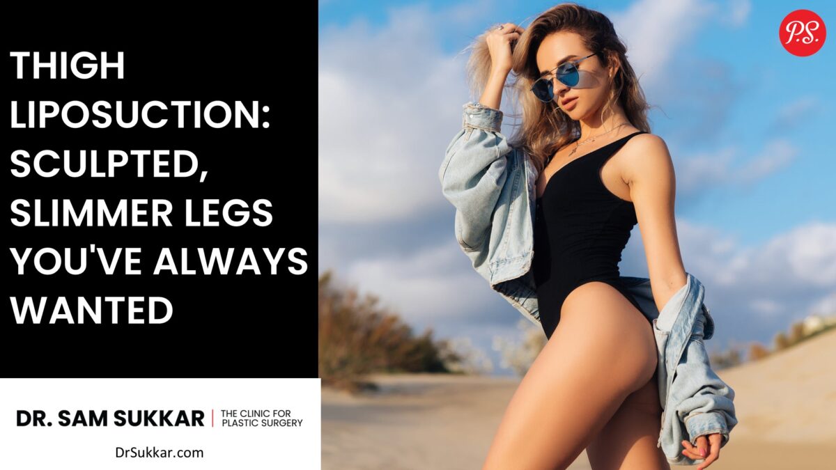 Thigh Liposuction: Sculpted, Slimmer Legs You've Always Wanted by Dr. Sam Sukkar, MD