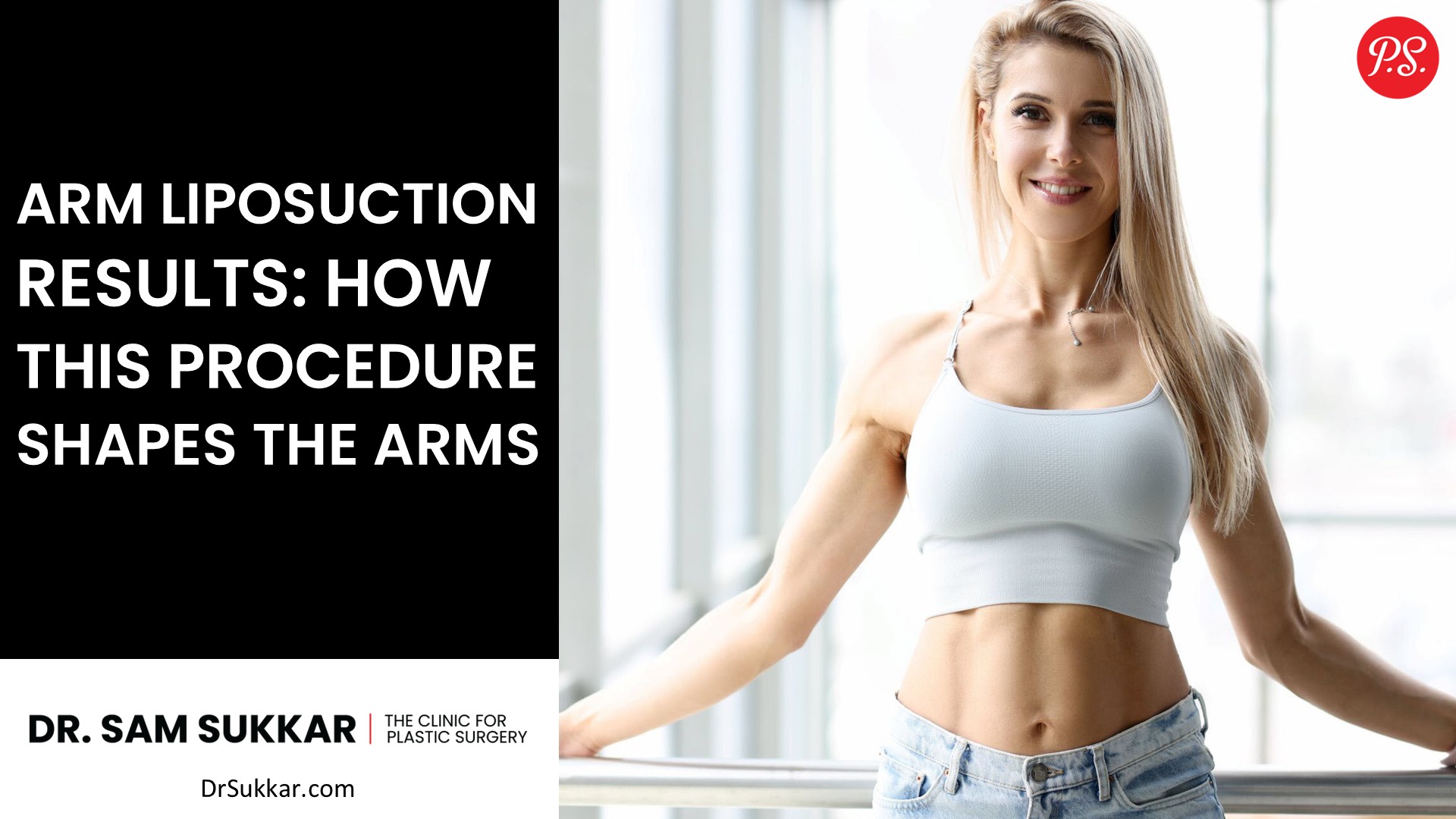Arm Liposuction Results: How This Procedure Shapes the Arms