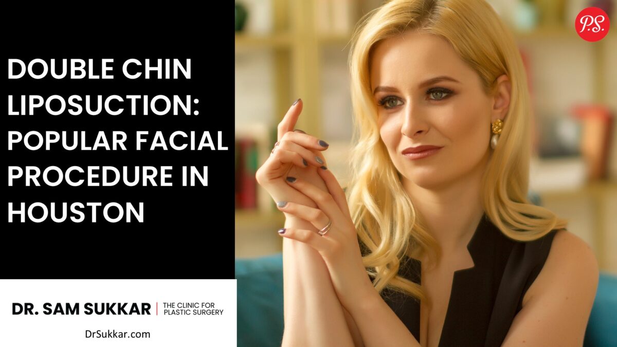 Double Chin Liposuction: Popular Facial Procedure in Houston By Dr Sam Sukkar MD