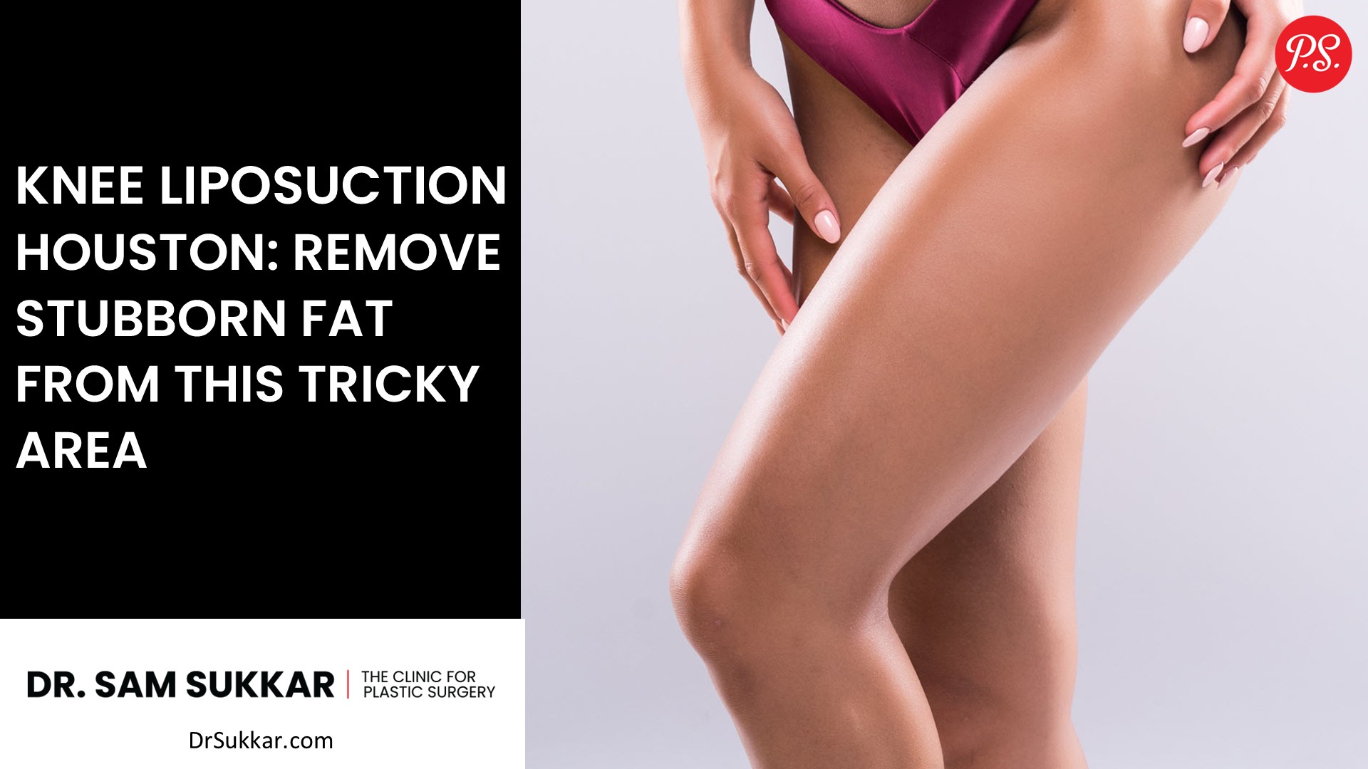 Knee Liposuction Houston: Remove Stubborn Fat from This Tricky Area