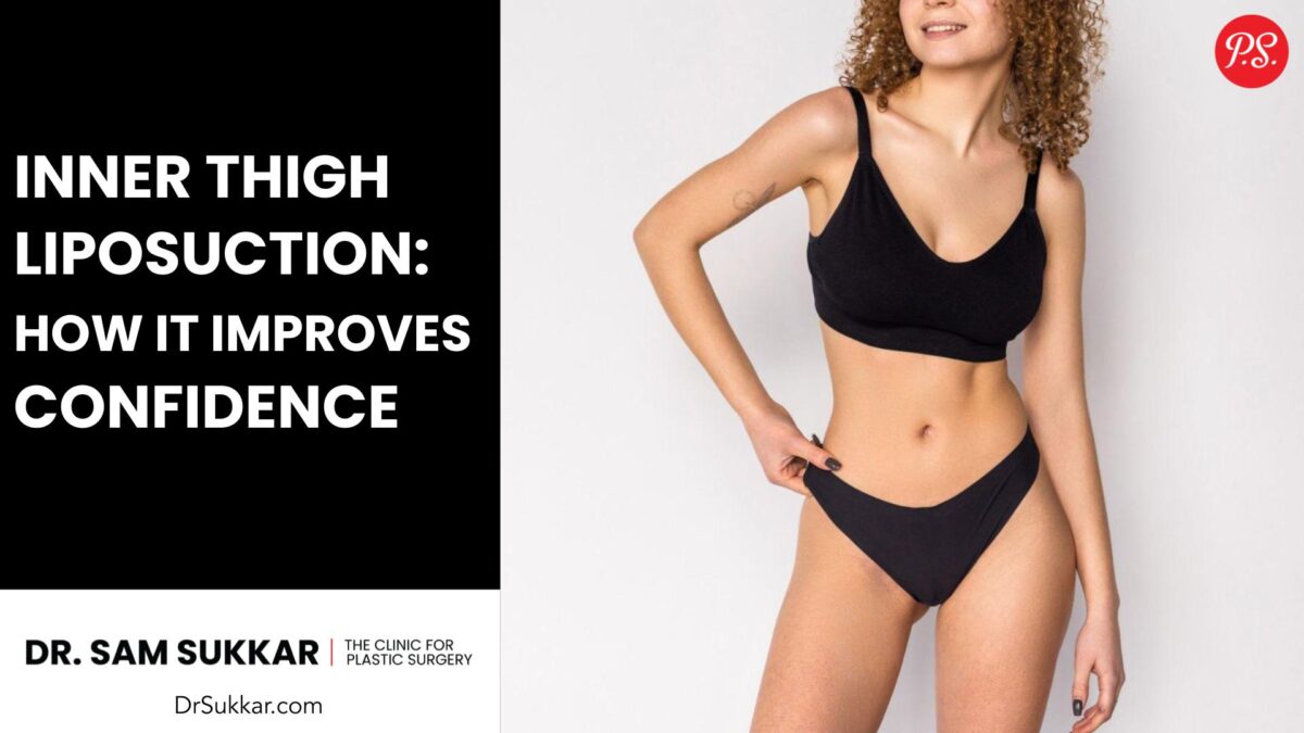 Inner Thigh Liposuction: How It Improves Confidence by Dr. Sam Sukkar, MD