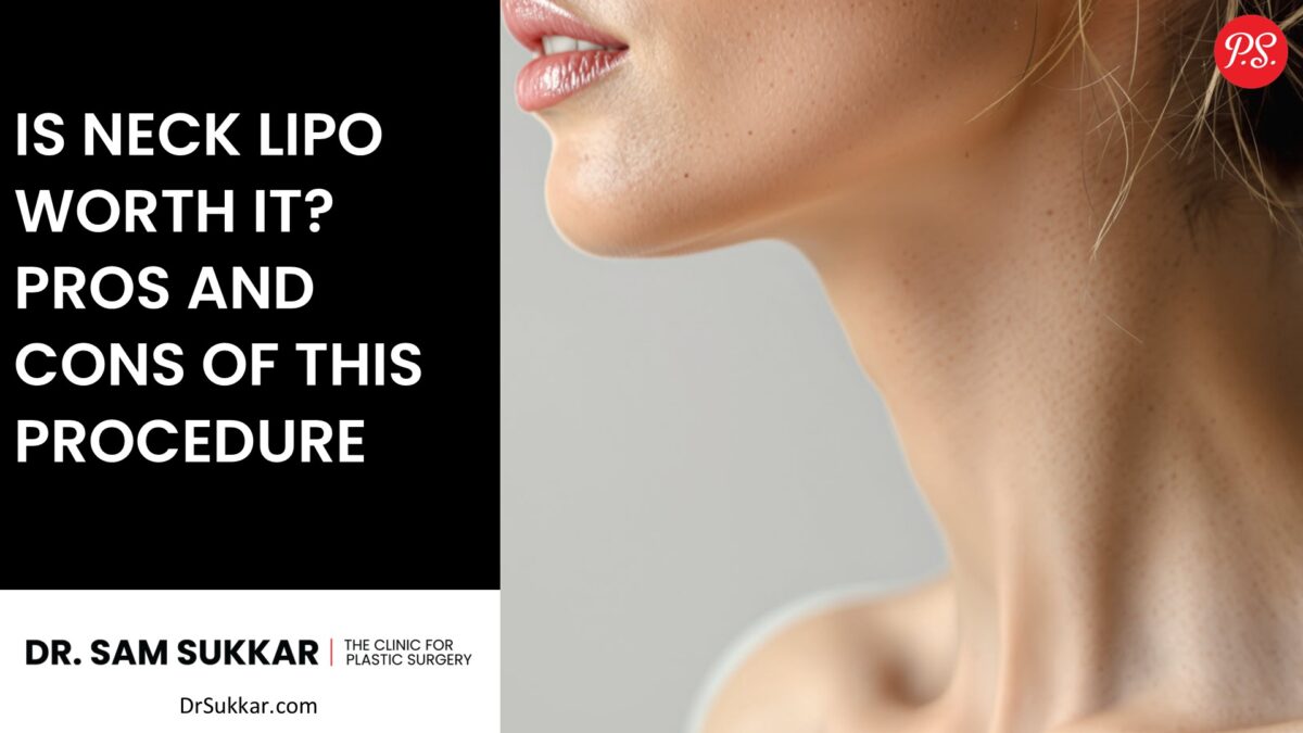 Is Neck Lipo Worth It? Pros and Cons of This Procedure by Doctor Sam Sukkar MD