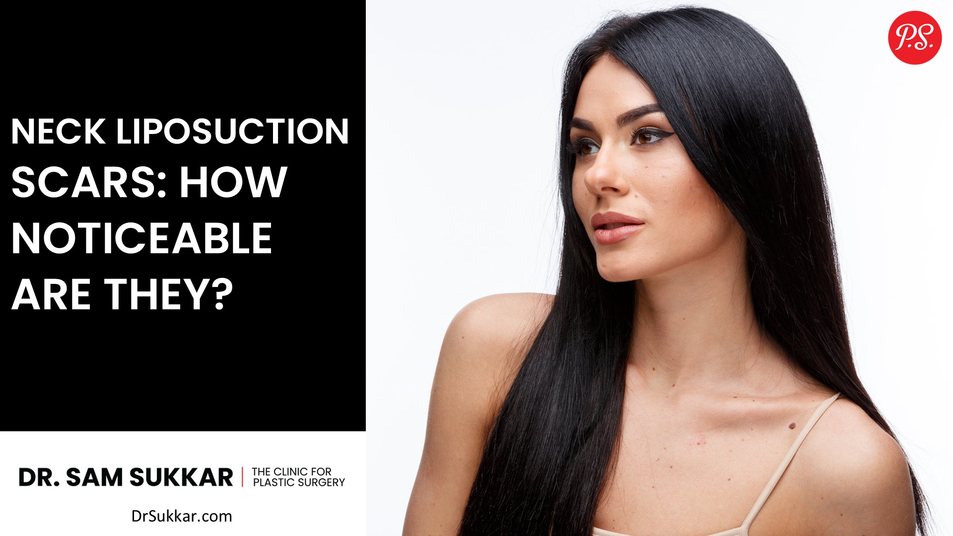 Neck Liposuction Scars: How Noticeable Are They?