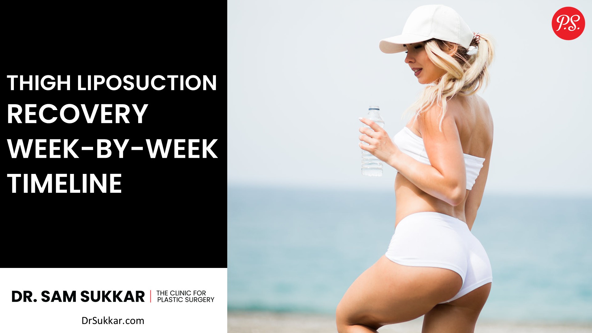 Thigh Liposuction Recovery Week-by-Week Timeline