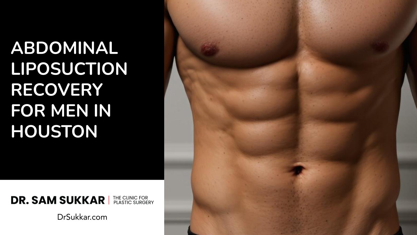 Abdominal Liposuction Recovery for Men in Houston