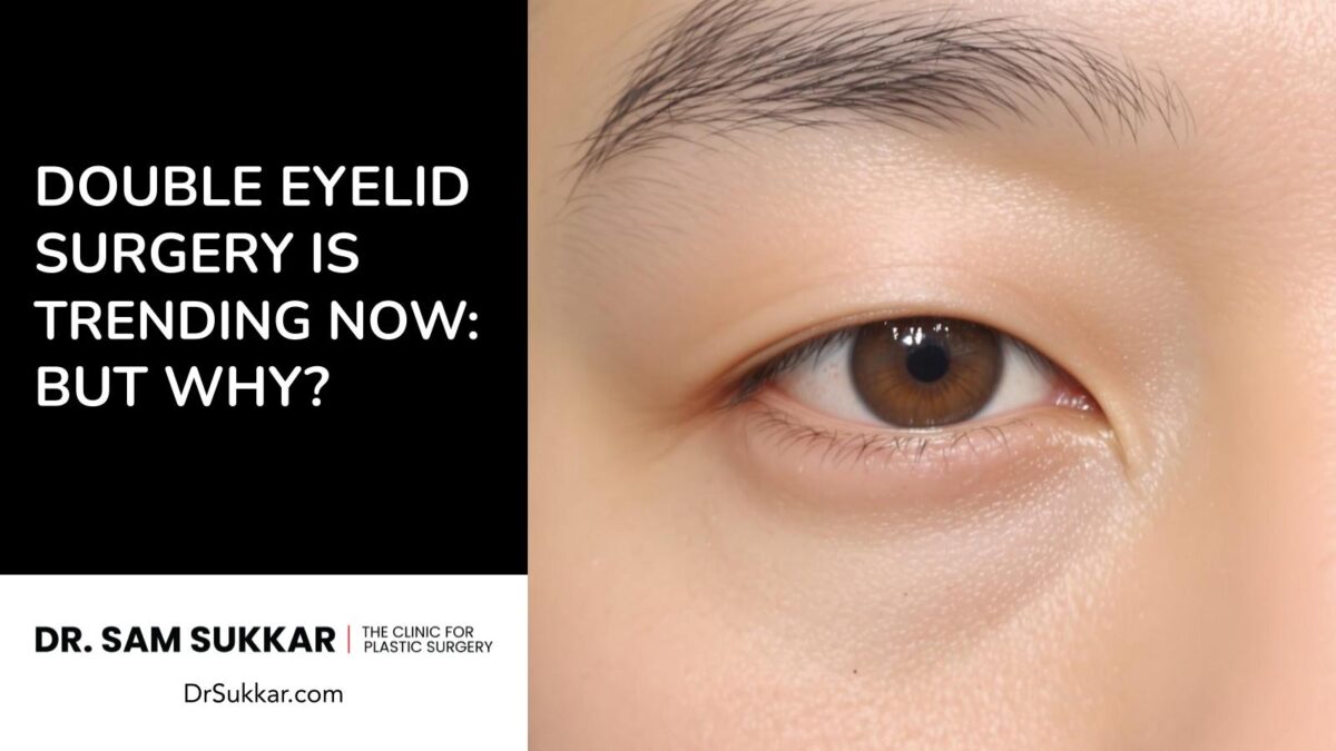 Double Eyelid Surgery is Trending Now: But Why? by Dr. Sam Sukkar, MD