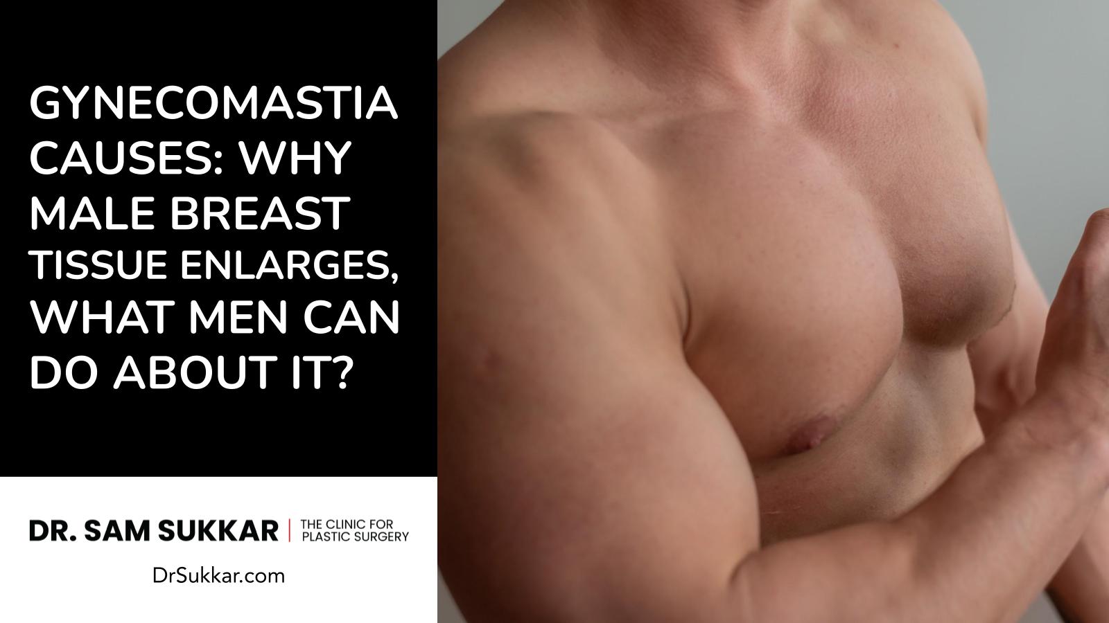 Gynecomastia Causes: Why Male Breast Tissue Enlarges, What Men Can Do About it?