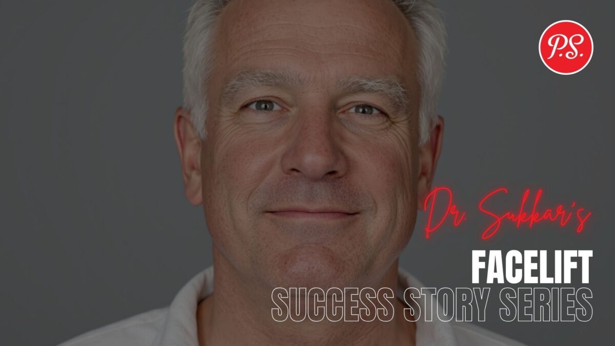 Houston Facelift at 63: Male Executive’s Transformation - Facelift Success Story Series by Dr. Sam Sukkar, MD