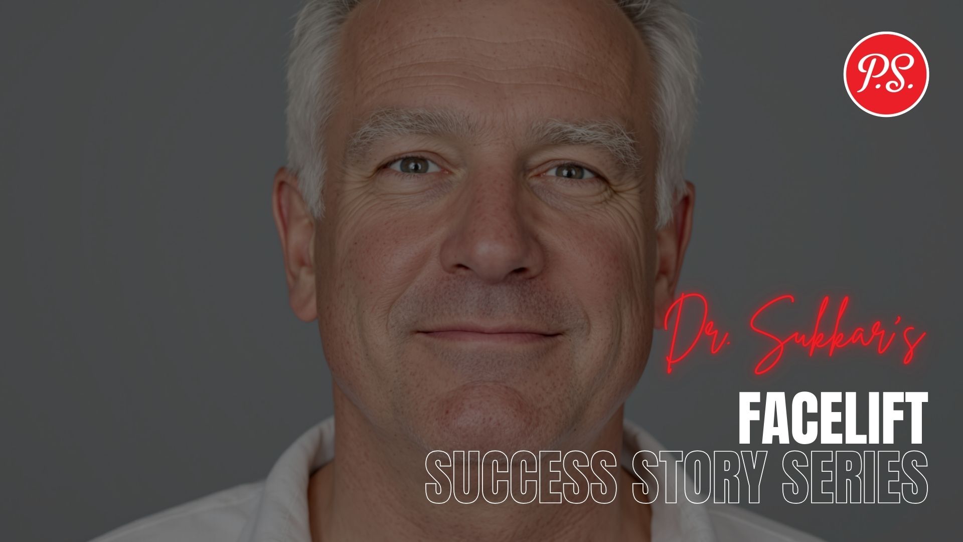 Facelift at 61: Houston Patient’s Natural Rejuvenation