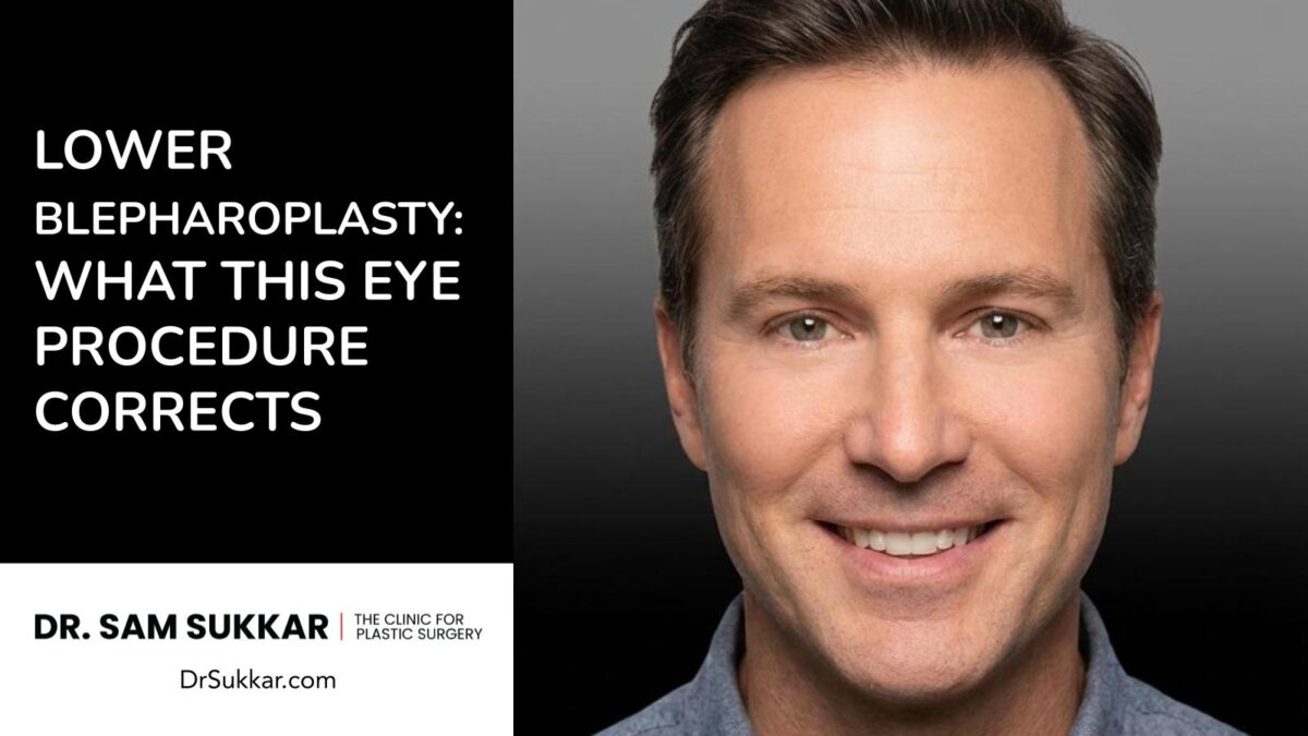 Lower Blepharoplasty: What This Eye Procedure Corrects by Dr. Sam Sukkar, MD