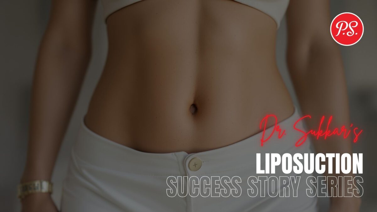 VASER Liposuction Success: 41-Year-Old’s Houston Journey - Liposuction Success Story Series by Dr. Sam Sukkar, MD