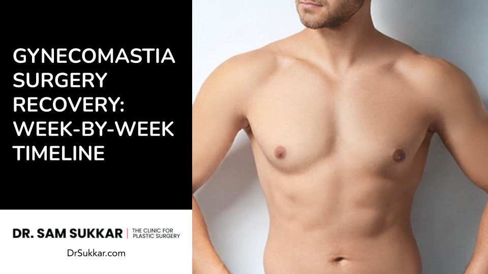 Gynecomastia Surgery Recovery: Week-By-Week Timeline