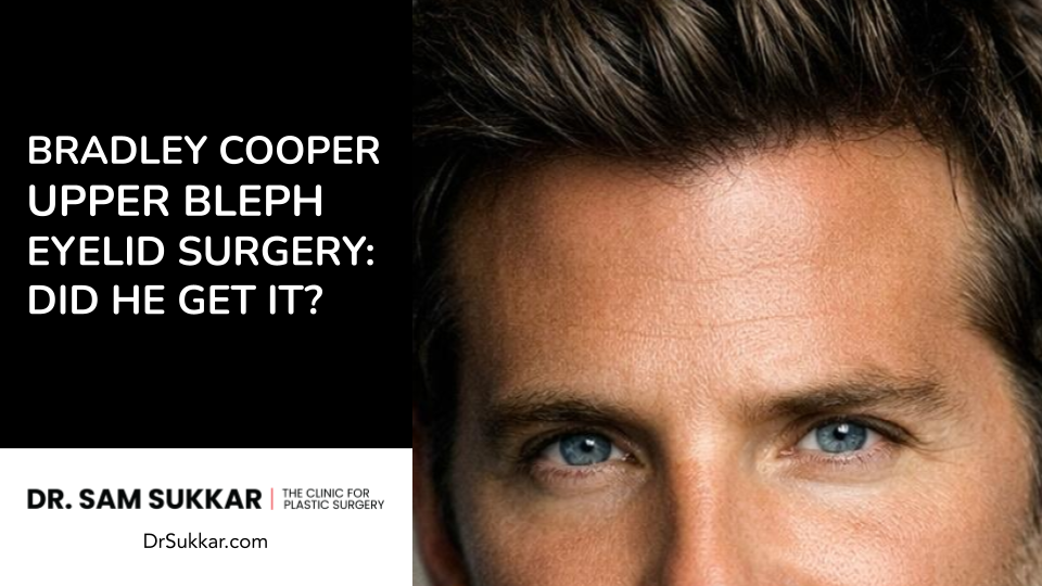 Bradley Cooper Upper Bleph Eyelid Surgery: Did He Get It?