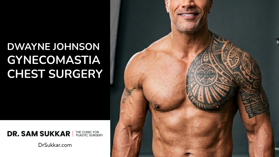 Dwayne “The Rock” Johnson Gynecomastia Chest Surgery
