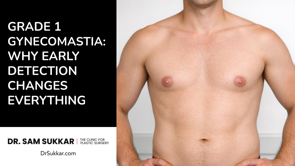 Grade 1 Gynecomastia: Why Early Detection Changes Everything by Dr. Sam Sukkar, MD