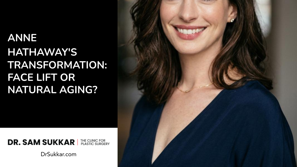Anne Hathaway’s Transformation: Facelift or Natural Aging?