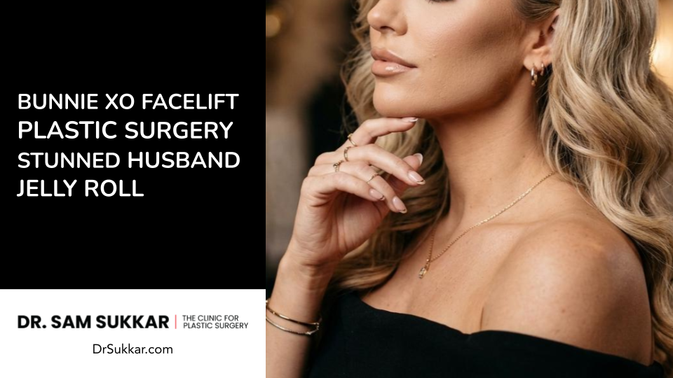 Bunnie Xo Facelift Plastic Surgery Stunned Husband Jelly Roll by Dr. Sam Sukkar, MD