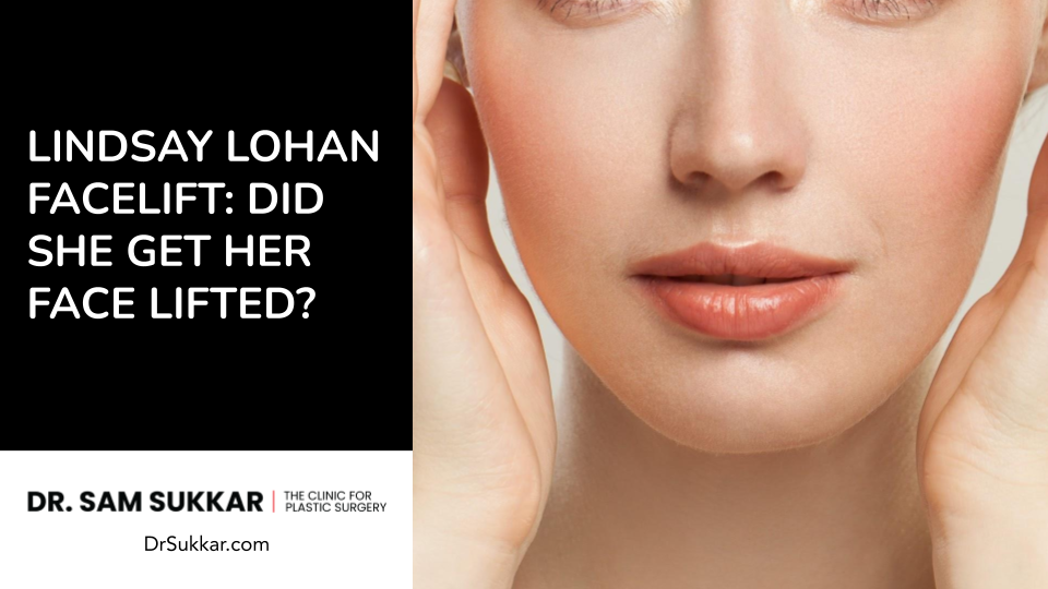 Lindsay Lohan Facelift: Did She Get Her Face Lifted?
