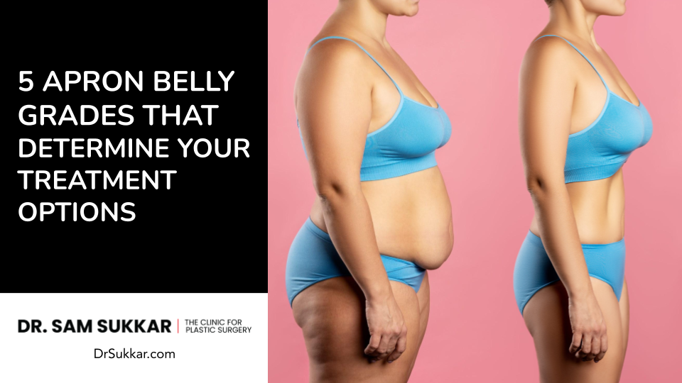 5 Apron Belly Grades That Determine Your Treatment Options