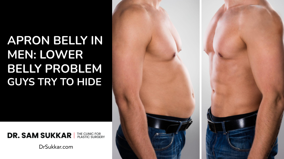 Apron Belly in Men: Lower Belly Problem Guys Try to Hide