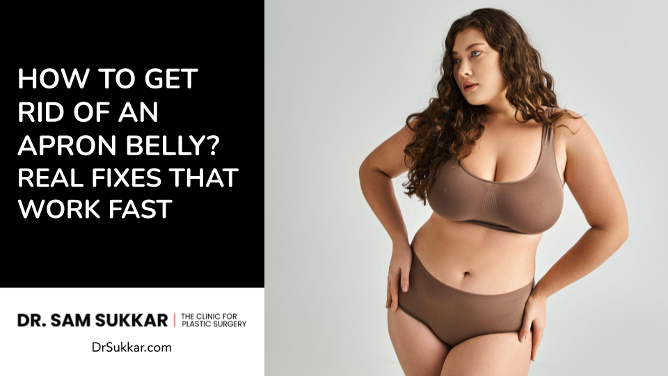 How to Get Rid of an Apron Belly? Real Fixes That Work Fast