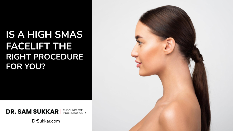 Is a High SMAS Facelift the Right Procedure for You?