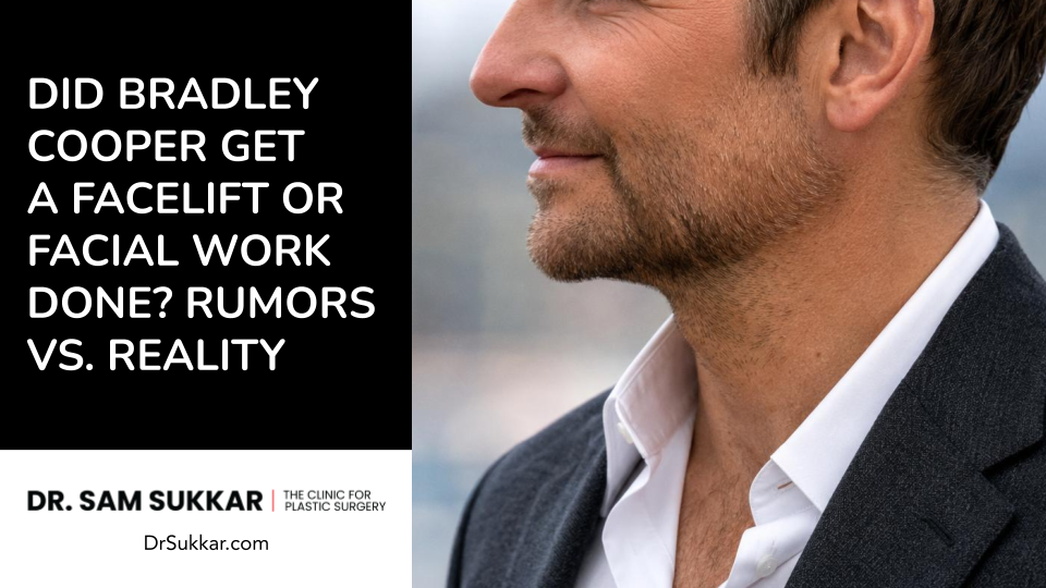 Did Bradley Cooper Get a Facelift or Facial Work Done? Rumors vs. Reality
