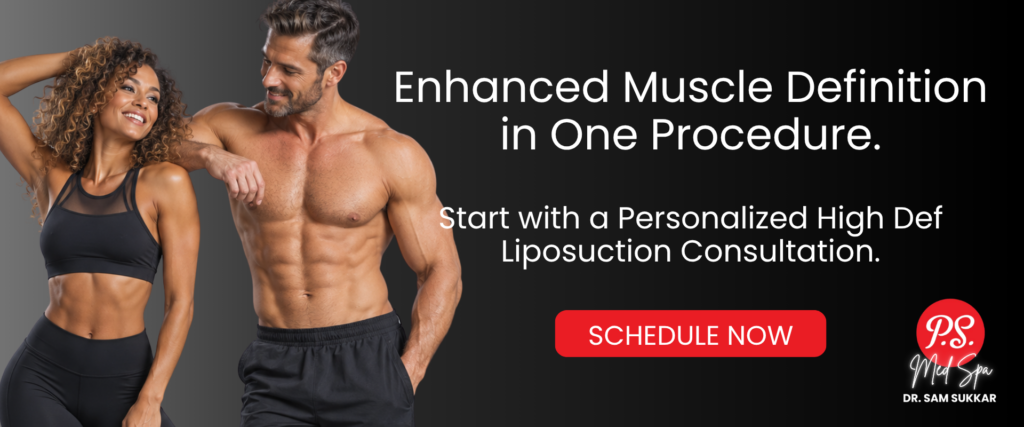 High Definition Liposuction Before and After Photos in Houston Texas