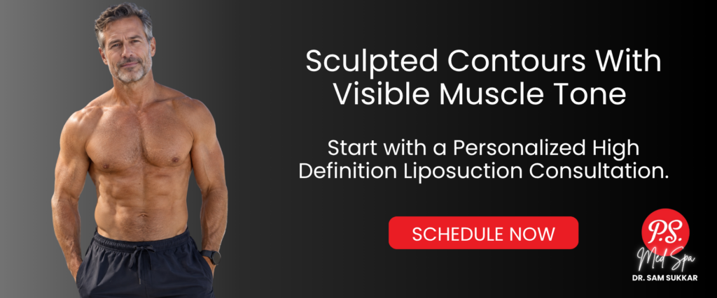 High Definition Liposuction Benefits in Houston, TX